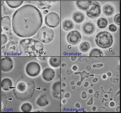 blastocystis